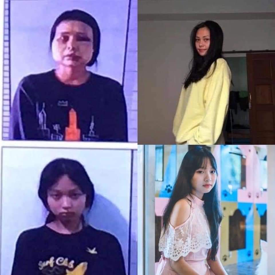 Kwee_K_K's tweet photo. These two girls were brutally beaten up, abducted and taken by MilitaryJuntas! I condemn beatings, harassments and attacks to valued women! Military Juntas has been abusing us everyday and it's getting worse! Please pray for us and speak for everyone🙏
#SaveMyanmar https://t.co/0hITccqHyz