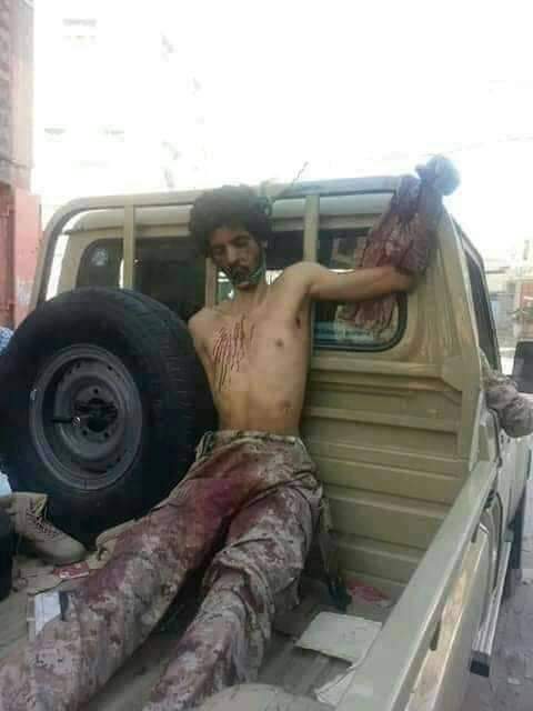 الى الدنابيع اللي مع زيود شيعة اليمن يريدوا يحرروا عدن جريمه في مأرب تعذيب احد جنود الشرعيه من ابناء ابين من جماعة العوبان ويدعى عباس الطاهري راح يستلم راتبه من مأرب تم خصم من راتبه ثلث الراتب دون اي سبب تم ملاسنه بينه وبين اللجنه و تم ضربه بأعقاب البنادق والذي قام بضربه اكثر