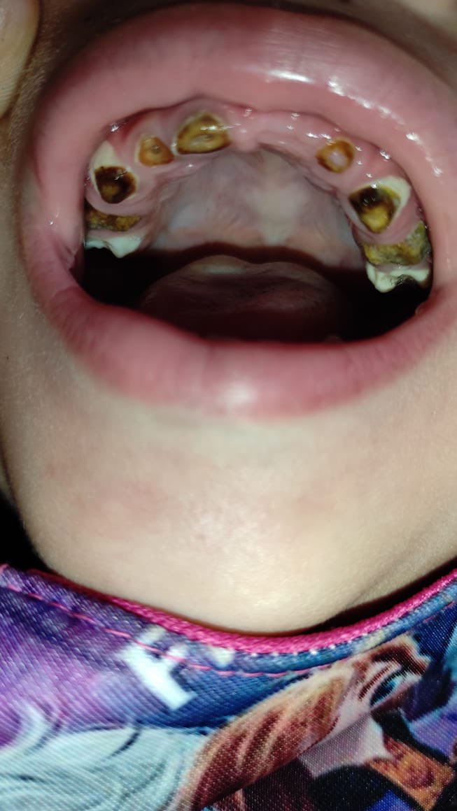 JulieGilbertW's tweet photo. Ahí están los puntos de infección. Estamos fallando como primer nivel, y si fallamos nosotros, falla todo el sistema de salud. https://t.co/YMAqkb5eZe