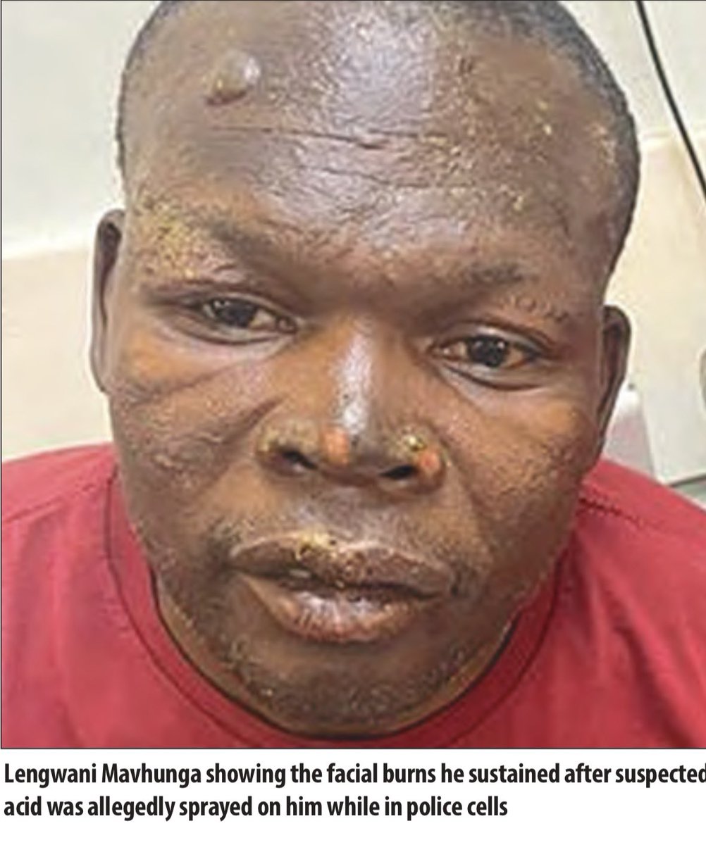 mafirakureva18's tweet image. ....Cdes...It is better to recognise that we are in darkness than to pretend that we can see the light...

...We are in crisis...

#NotYetUhuru 
#ZIM41 
#ZanuPfMustGo