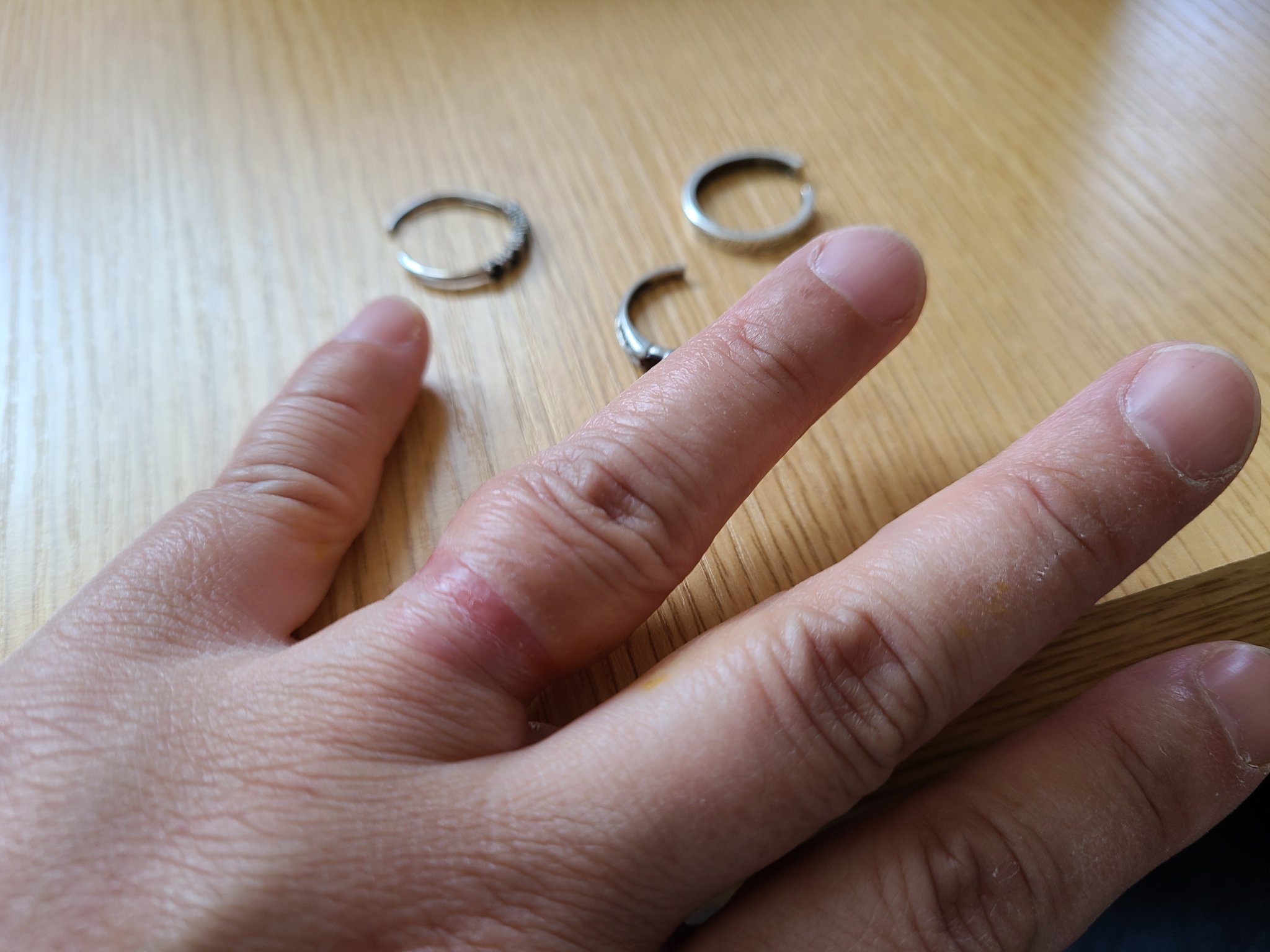 リングカッター Twitter Search Twitter