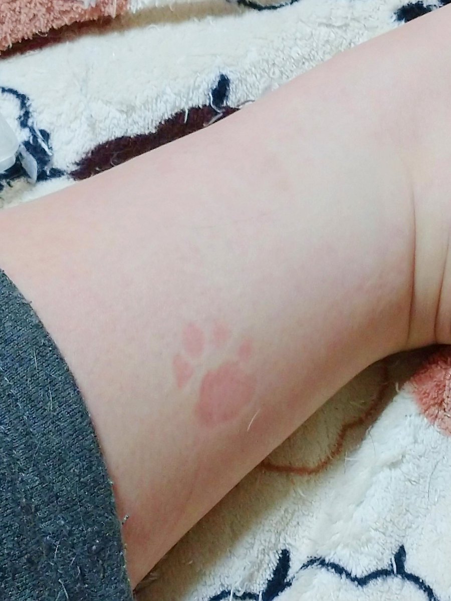 猫さんにつけられたリアル肉球スタンプが羨ましいったらない そんなくっきり跡つくことある Togetter 猫さんにつけられたリアル肉球スタンプが羨ましいったらない そんなくっきり跡つくことある Togetter