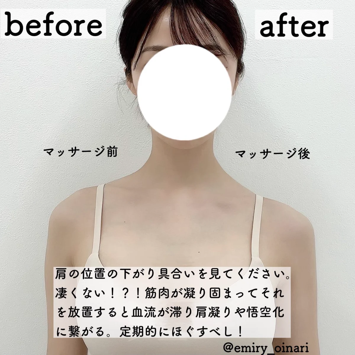 肩の筋肉が凝り固まってる人必見！僧帽筋マッサージがおすすめ！