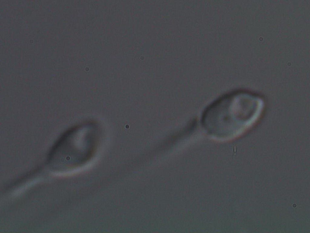 IVFLIFE's tweet photo. Have your say of Sperm Morphology 
Tomorrow @ivf_initiative 
https://t.co/DvD4yqNhhO https://t.co/51lFoXZr4g
