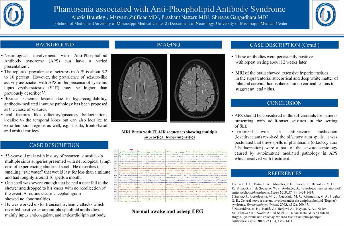 UMMC Student Interest Group in Neurology (@ummc_sign) on Twitter photo Wanna learn about phantosmia (olfactory hallucination)? Check this poster by SIGN member and M3 Alexis Brantley!
@NMatch2021 <a href="/lucypersaud/">Lucy Persaud</a> <a href="/myelinMD/">Alissa Willis</a> <a href="/UMMC_NeuroRes/">UMMC Neurology Residency Program</a> <a href="/LAWoodwardMD/">LouAnn Woodward M.D.</a> <a href="/JimmyStewart14/">Jimmy Stewart</a> <a href="/lojackwms/">Loretta Jackson</a> @nsicumommamd14
#FutureNeurologist #neurotwitter #AANAM #MedStudentTwitter Wanna learn about phantosmia (olfactory hallucination)? Check this poster by SIGN member and M3 Alexis Brantley!
@NMatch2021 <a href="/lucypersaud/">Lucy Persaud</a> <a href="/myelinMD/">Alissa Willis</a> <a href="/UMMC_NeuroRes/">UMMC Neurology Residency Program</a> <a href="/LAWoodwardMD/">LouAnn Woodward M.D.</a> <a href="/JimmyStewart14/">Jimmy Stewart</a> <a href="/lojackwms/">Loretta Jackson</a> @nsicumommamd14
#FutureNeurologist #neurotwitter #AANAM #MedStudentTwitter