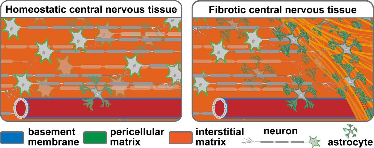 Acta Biomaterialia (@actabio) on Twitter photo REVIEW by Professor Sarah Calve: Tissue-specific parameters for the design of #ECM-mimetic biomaterials <a href="/CalveLab/">Sarah Calve</a> <a href="/CUEngineering/">CU Boulder Engineering 🦬</a> sciencedirect.com/science/articl… REVIEW by Professor Sarah Calve: Tissue-specific parameters for the design of #ECM-mimetic biomaterials <a href="/CalveLab/">Sarah Calve</a> <a href="/CUEngineering/">CU Boulder Engineering 🦬</a> sciencedirect.com/science/articl…
