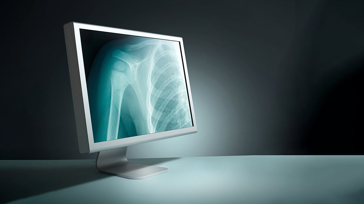 DoctorRHK's tweet photo. Did you ever imagine that hybrid CT-fluoroscopy can be used in interventional radiology? If not, you should think of it now. The hybrid CT-fluoroscopy can be used for advanced combination imaging procedures. Read the article below for more information:
https://t.co/tRnD9WXNMU https://t.co/7XyaEJioYY