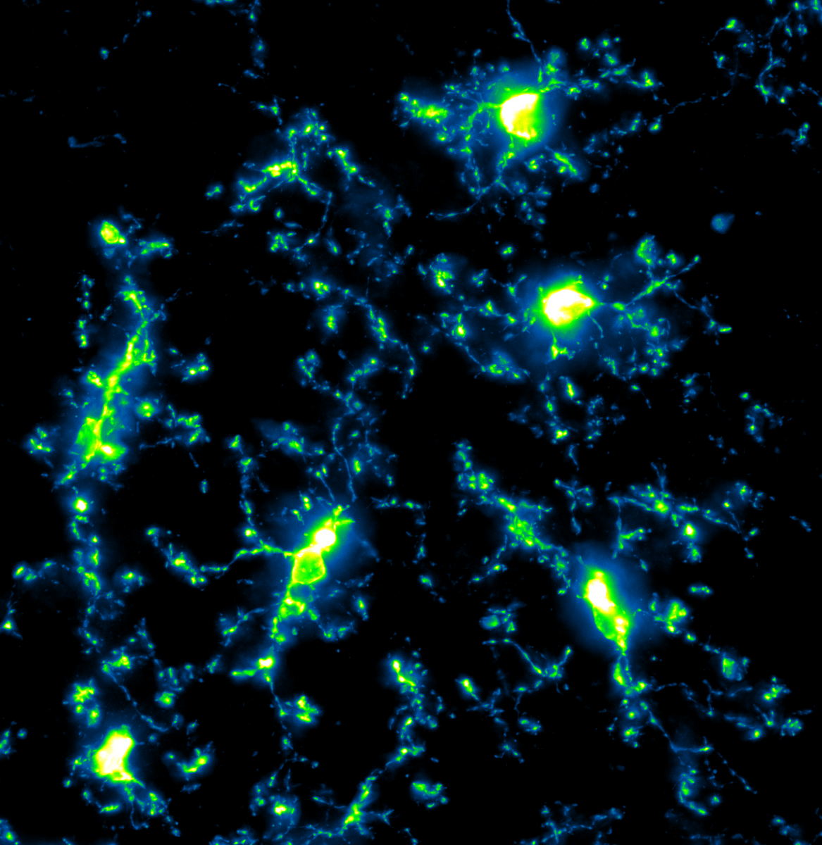 Microglia stress eat because it's an effective coping strategy :)  (from this past week of being @hannahkloo 's plucky sidekick)