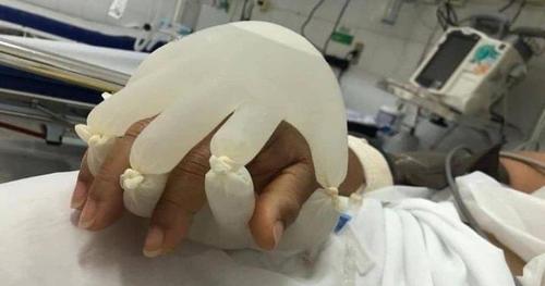 Limportant_fr's tweet photo. Brésil. Des infirmières inventent une «Main de Dieu» pour lutter contre l'isolement des malades du Covid-19 https://t.co/dkNabSHBkt @Demotivateur https://t.co/vJtBTRXUY8