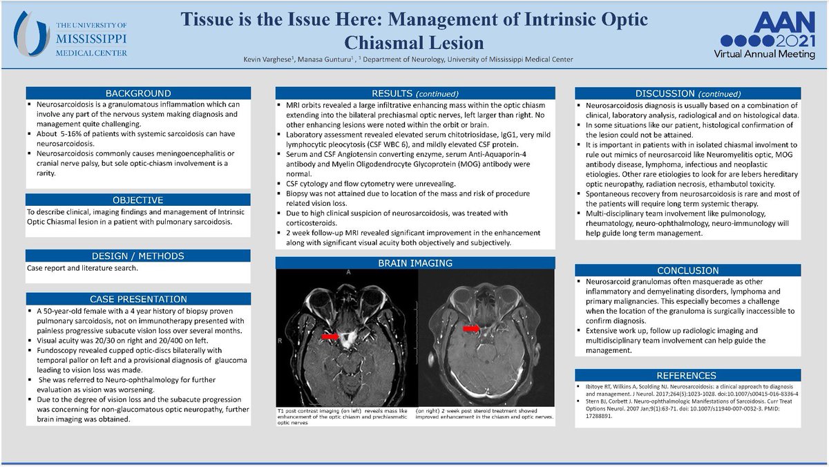 UMMC Student Interest Group in Neurology (@ummc_sign) on Twitter photo Last poster of the day - SIGN member and M3 Kevin Varghese describes the management of an optic chias mail lesion especially when it is surgically inaccessible! #endneurophobia #AANAM #futureneurologist
@AANMember <a href="/lucypersaud/">Lucy Persaud</a> <a href="/UMMCnews/">The University of Mississippi Medical Center</a> <a href="/lojackwms/">Loretta Jackson</a> <a href="/myelinMD/">Alissa Willis</a> <a href="/DGlaucomflecken/">Dr. Glaucomflecken</a> Last poster of the day - SIGN member and M3 Kevin Varghese describes the management of an optic chias mail lesion especially when it is surgically inaccessible! #endneurophobia #AANAM #futureneurologist
@AANMember <a href="/lucypersaud/">Lucy Persaud</a> <a href="/UMMCnews/">The University of Mississippi Medical Center</a> <a href="/lojackwms/">Loretta Jackson</a> <a href="/myelinMD/">Alissa Willis</a> <a href="/DGlaucomflecken/">Dr. Glaucomflecken</a>