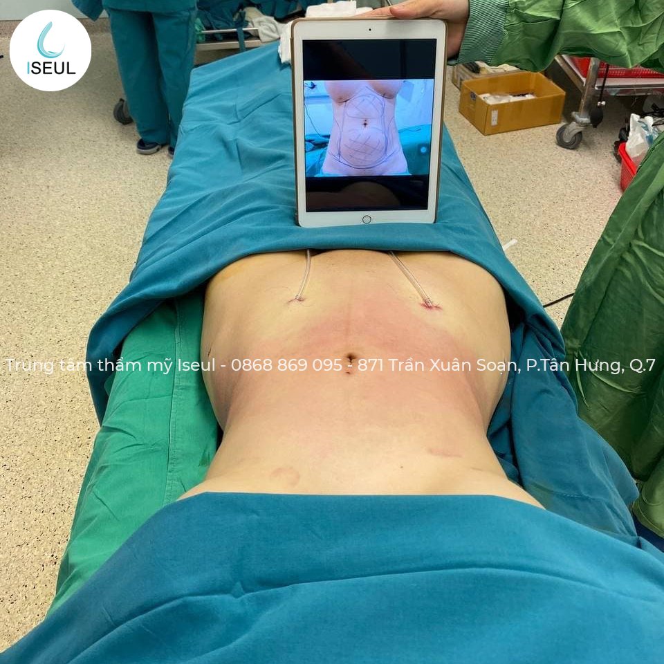 ISEUL PLASTIC SURGERY (@iseulsurgery) / Posts / X