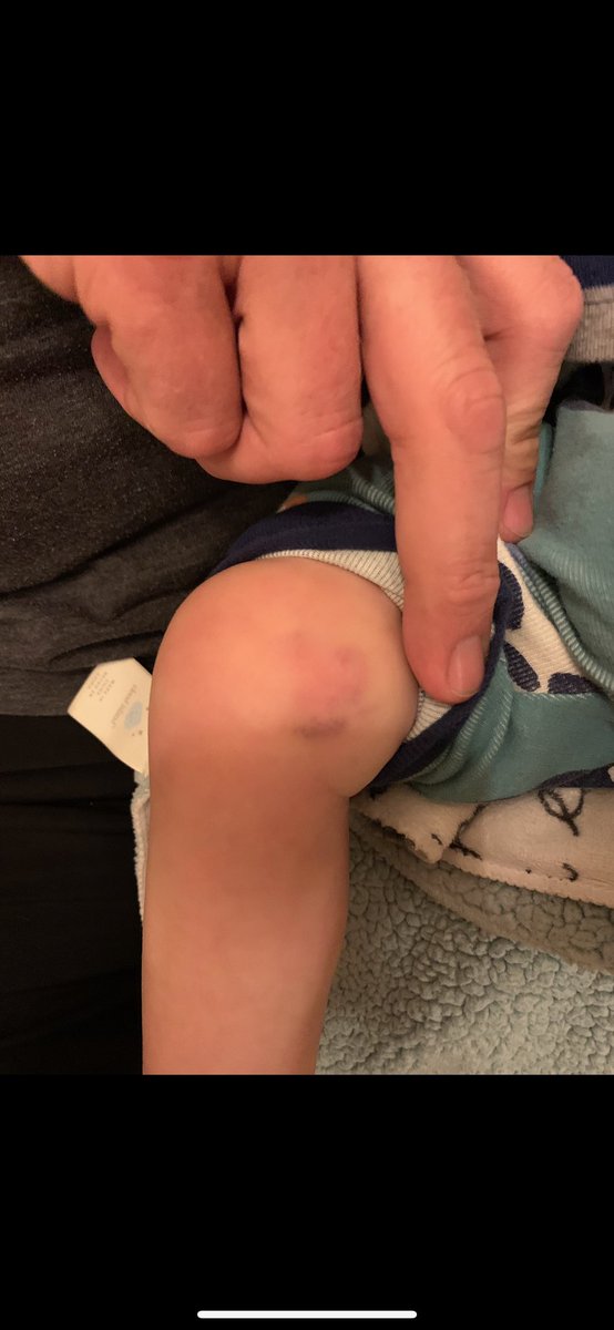 MontePyburn's tweet photo. @DeltaChildren  my grandson was injured in this crib last night produced by Simmons. Monterey 4 in 1 was the style this product should be recalled. https://t.co/yJV9GJYXBR