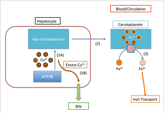 jvan_do's tweet photo. Great Review of Wilson's Disease Pathophysiology. Ceruloplasmin plays a role in both copper and iron metabolism!
ATP7B mutation->⬆️hepatic copper accumulation and ⬇️ceruloplasmin->⬆️hepatic iron deposition
@CLD_Learning @AASLDtweets #CLDSoMeREPS #CLDREP
https://t.co/7ptQZtE8ZR https://t.co/QftVVGh7kb