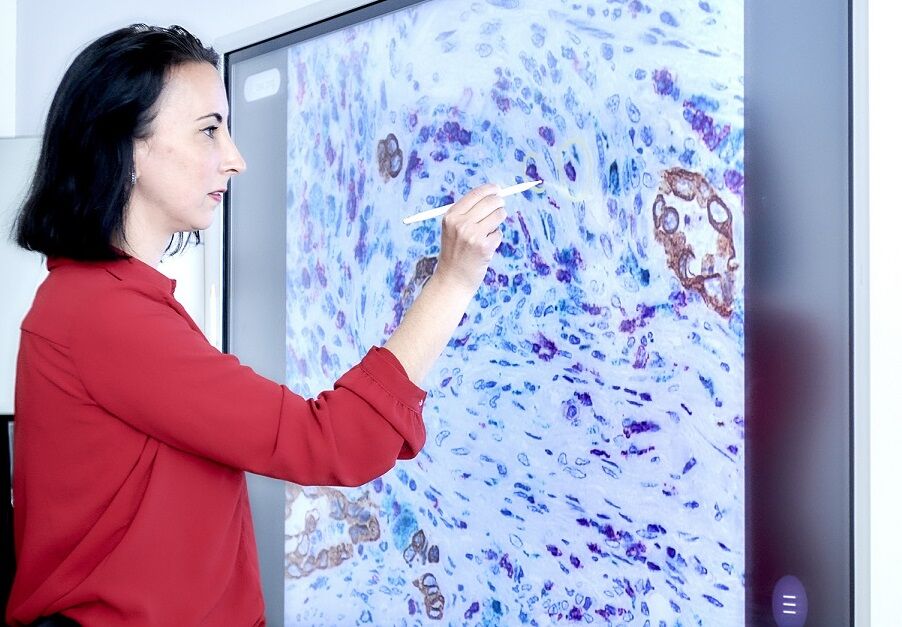 ng_tma's tweet image. Under #ngTMA concept: #tissuemicroarray, #multiplexing, #histology, #pathology, #consultation, #digitalization , #AI, #MachineLearning, #ngTMA is today one of the best tools to evaluate the #Tumormicroenvironment in #colorectalcancer . More info: ngtma.com
