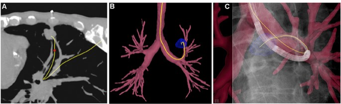 RadiolMed's tweet photo. Editor's Pick: AI and Interventional Radiology
Interventional Radiology ex-machina: impact of Artificial Intelligence on practice
https://t.co/6pgx6XBbdV
#radiology #AI @ClinMedJournals #IRad @interventistica @NIH #interventionalradiology https://t.co/zUPmugssQo