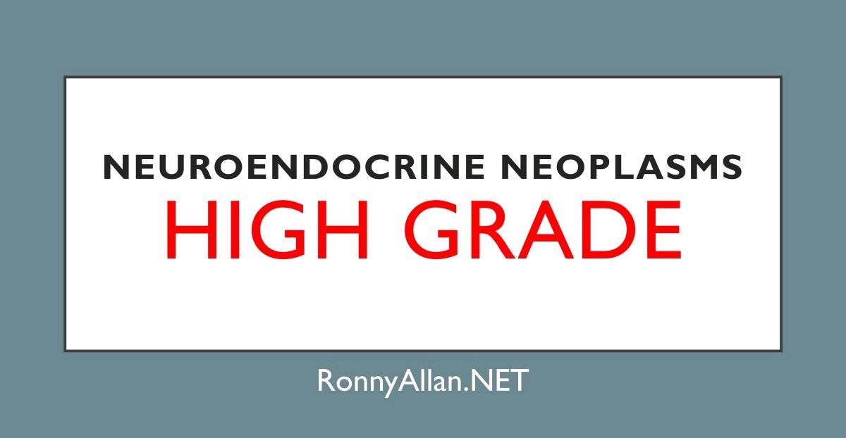 Neuroendocrine Neoplasms – High grade
#NeuroendocrineCancer via @ronnyallan1
 buff.ly/2E90S09
