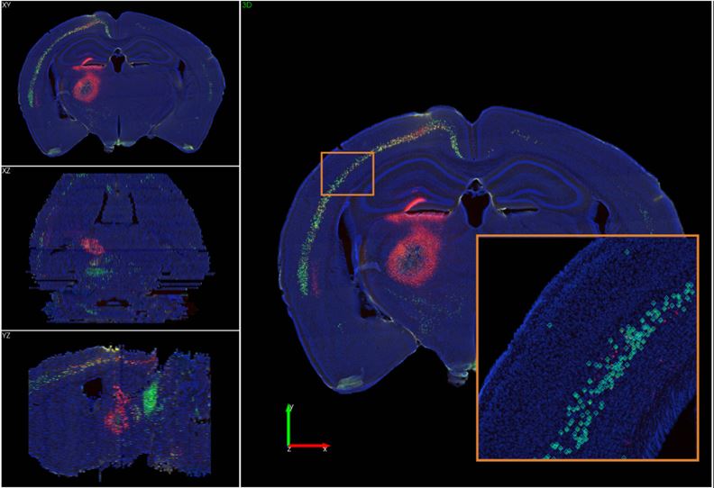 MBFBioscience's tweet photo. Webinar Update!
Join us on Tuesday, May 4th, for a deep dive into #NeuroInfo's #machinelearning cell detection workflow.
We'll be demonstrating how to detect cells in #3Dbrainvolumes and register them to the Allen Mouse Brain Atlas!
Register: https://t.co/X1EQyIJ9lB https://t.co/oVt0mLAdVd