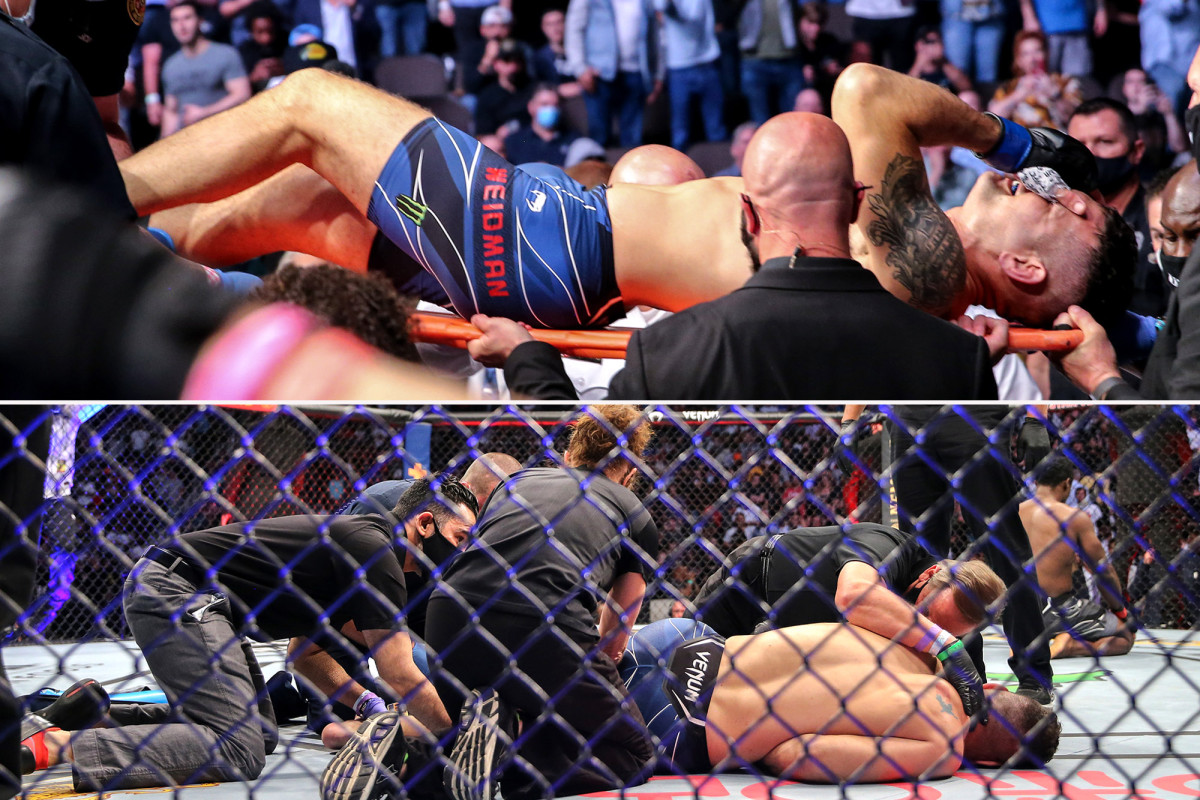 Chris Weidman shows just how gruesome leg injury at UFC 261 was
