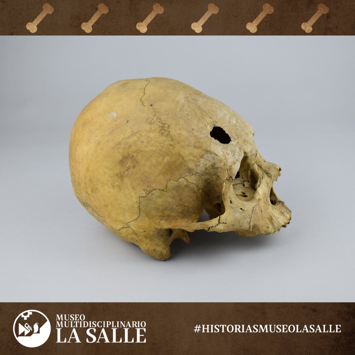 MuseoLaSallePE's tweet photo. ¿Un eslabón perdido? No. Este cráneo deformado es evidencia de las prácticas culturales de muchas sociedades del mundo antiguo, así como ese agujero, que corresponde a una trepanación. En el Perú, ¿sabes qué sociedades prehispánicas las practicaban? #HistoriasMuseoLaSalle https://t.co/HDdmTCFY5n