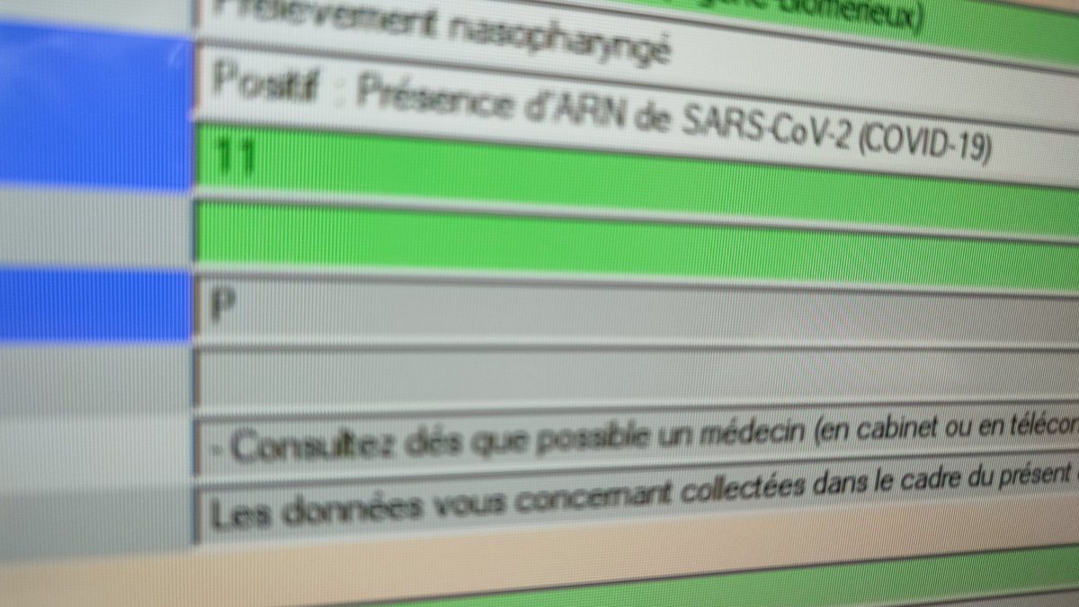 11 CT celui là... Un personnel de l'hôpital de 41 ans non vacciné alors qu'il est éligible depuis début mars..