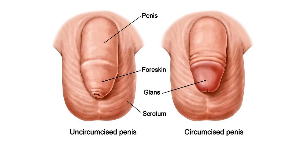 An uncircumcised penis needs more attention to maintain good hygiene compared to a circumcised one. The foreskin attract more germs and dirt.Please RT for awareness