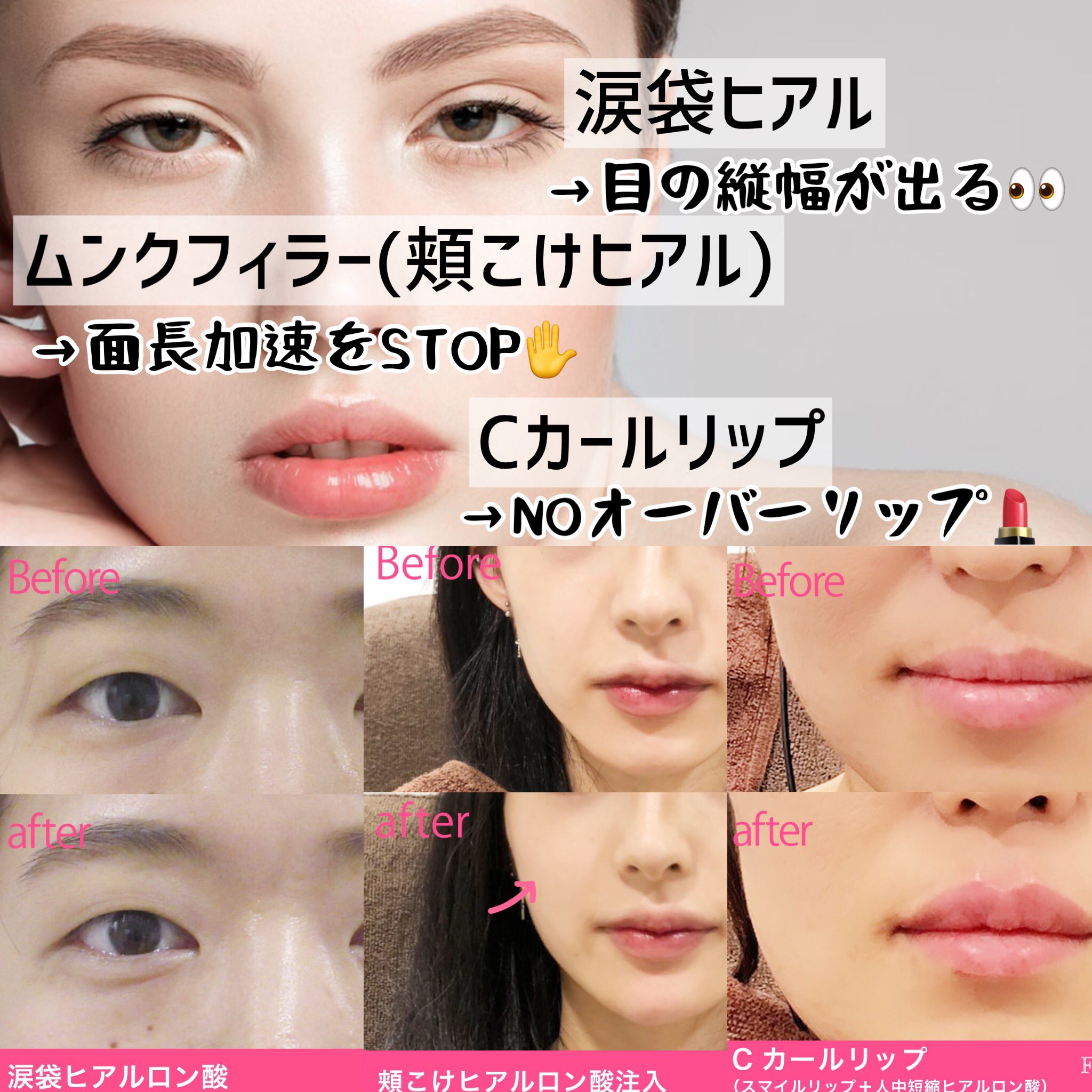 頬こけ Twitter Search Twitter
