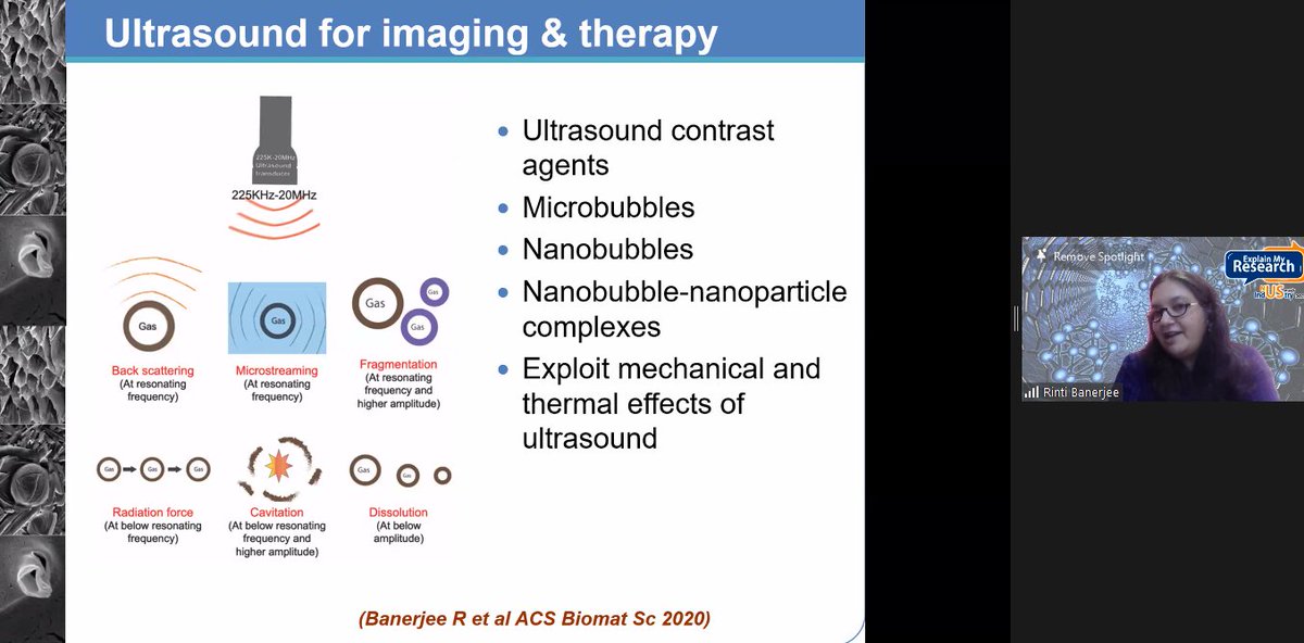 TheWackerLab's tweet photo. Rinti Banerjee talking live about ultrasound-triggered microbubbles. #amazingtalks #explainmyresearch https://t.co/ld6k2FYSjp