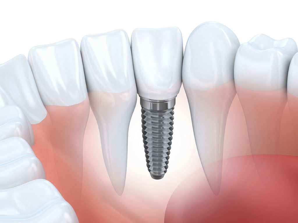 dentistryfm2021's tweet photo. Advanced Dentistry 2021 will give dental undergraduates the latest information 
on the application process &amp; learn what to expect as a dental student
and will also answer your questions.
Book at https://t.co/LGNRn2FwjC
#dentistry #dentalcare #DENT #ucsfdentistry #ColumbiaCDM https://t.co/NuTMcBVlrN