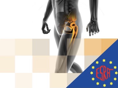 #LocorregionalSEDAR Si te interesa actualizarte sobre los bloqueos para cirugía de cadera ¡Inscríbete al webinar de la ESRA este próximo jueves! 🔗esraeurope.org/meeting/blocks… #esraeurope