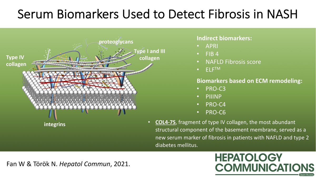 HepCommJournal's tweet photo. Editorial on #NASH biomarkers in #diabetes 👇
https://t.co/r4T5DHYJfM
Type IV Collagen 7S Accurately Identifies Advanced Fibrosis in #NAFLD with T2#diabetes
https://t.co/oA51AsjIAh
#VisualAbstract #livertwitter #endocrinetwitter #openaccess @AASLDtweets @Stanford_GI https://t.co/5mKq9rs9L7