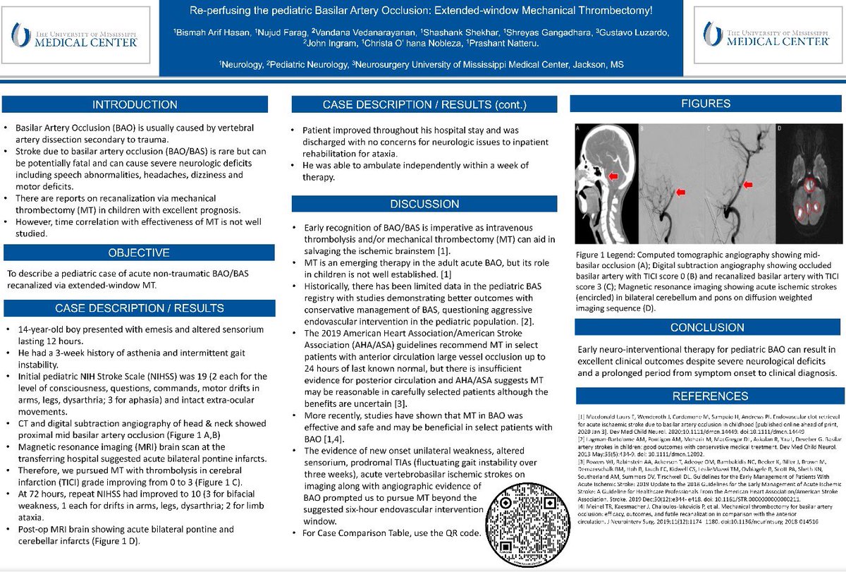 UMMC Student Interest Group in Neurology (@ummc_sign) on Twitter photo Incoming SIGN president Bismah Hasan shares this case of reperfusing the pediatric basilar artery via an extended window mechanical thrombectomy! @AANMember <a href="/StrokeAHA_ASA/">Stroke AHA/ASA</a> <a href="/svinsociety/">SVIN</a> <a href="/lucypersaud/">Lucy Persaud</a> <a href="/UMMCNeurosurg/">UMMC Neurosurgery</a> <a href="/neurocritical/">Neurocritical Care Society</a> <a href="/YoungNIR/">YoungNIR</a> #FutureNeurologist #AANAM #noLVOleftbehind Incoming SIGN president Bismah Hasan shares this case of reperfusing the pediatric basilar artery via an extended window mechanical thrombectomy! @AANMember <a href="/StrokeAHA_ASA/">Stroke AHA/ASA</a> <a href="/svinsociety/">SVIN</a> <a href="/lucypersaud/">Lucy Persaud</a> <a href="/UMMCNeurosurg/">UMMC Neurosurgery</a> <a href="/neurocritical/">Neurocritical Care Society</a> <a href="/YoungNIR/">YoungNIR</a> #FutureNeurologist #AANAM #noLVOleftbehind