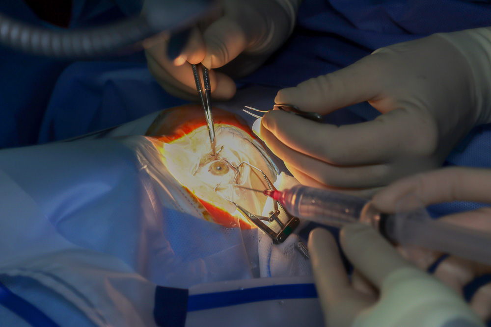 SANIDAD | El Hospital Universitario de Torrejón ha realizado desde 2012 más de 70 trasplantes de cornea 
➡️bit.ly/3dvh79Y
#TorrejónDeArdoz <a href="/HUdeTorrejon/">Hospital Universitario de Torrejón</a>