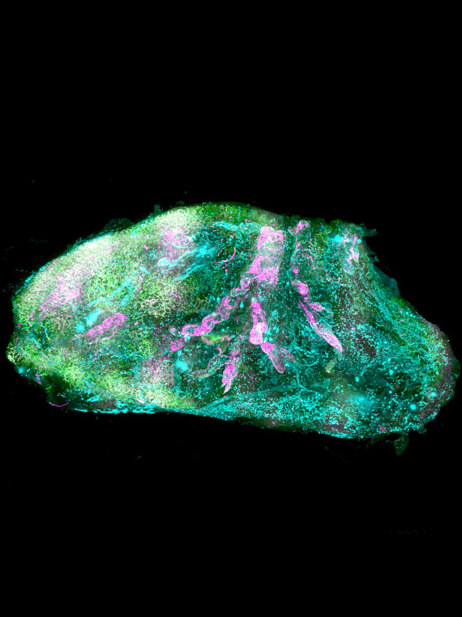 We are looking for an expert in light-sheet microscopy. We recently made intact human organs transparent. A grand challenge is now to make light-sheet microscope systems to image them. Please spread the word 🥳
erturk-lab.com/current-offer-…
#SHANEL #clearing #AI #imaging #humanorgans