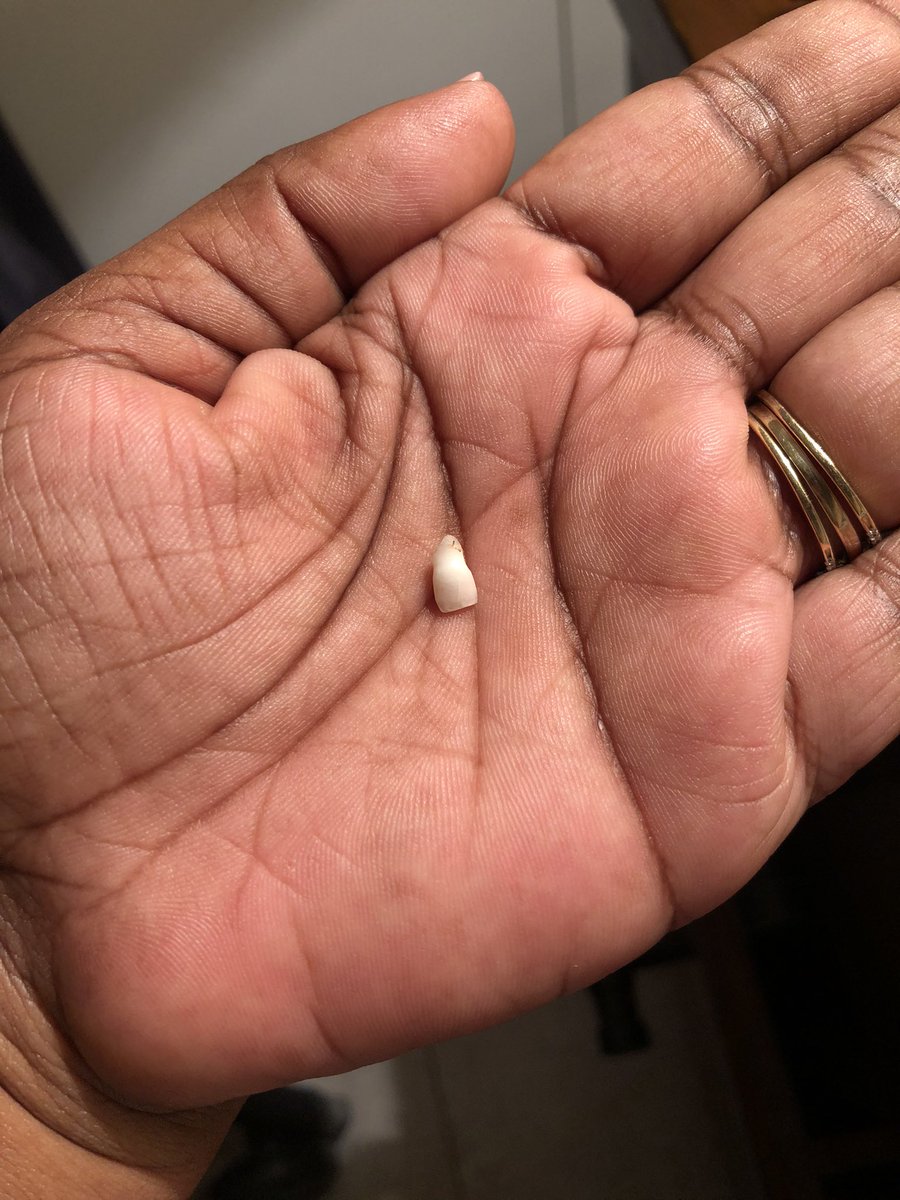 CarolOfori's tweet photo. So I am officially the ๐ฆท tooth ๐ง๐ฟโโ๏ธ fairy... so what do we do with the tooth after dropping the cash off? And how much must I give him for his tooth? #HelpAMama https://t.co/Y8yq8w3ZPJ