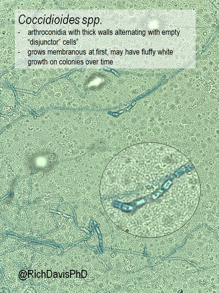 richdavisphd's tweet image. #MicroRounds (Day 843): For #LabWeek2021, I&apos;m highlighting #WhyClinMicroMatters with great catches by techs.

Fungal culture. Superficial source, lots of Penicillium. But suspicious tech looks behind it to find…

Coccidiodes spp.- a serious invasive mold #ASMClinMicro #IDTwitter