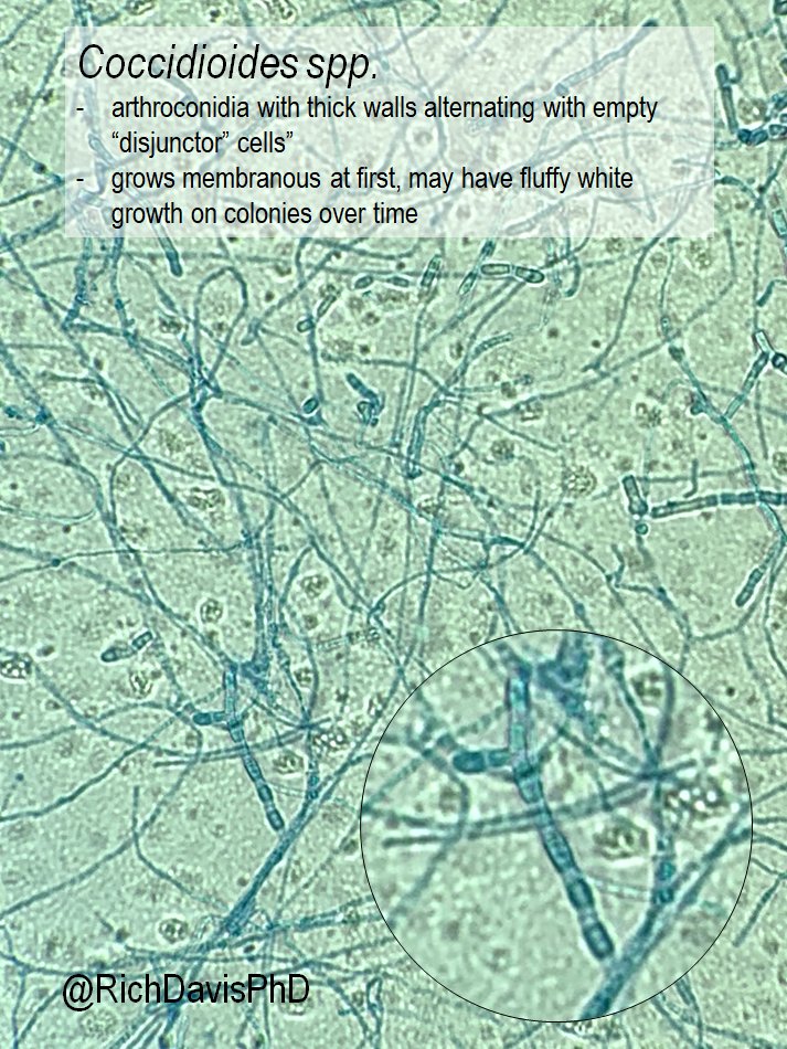 richdavisphd's tweet image. #MicroRounds (Day 843): For #LabWeek2021, I&apos;m highlighting #WhyClinMicroMatters with great catches by techs.

Fungal culture. Superficial source, lots of Penicillium. But suspicious tech looks behind it to find…

Coccidiodes spp.- a serious invasive mold #ASMClinMicro #IDTwitter