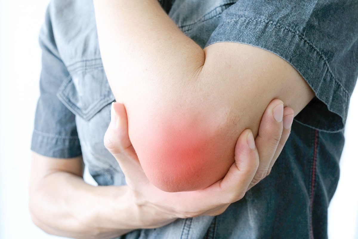 Бурмит отростка локтевого. Покраснение локтевого сустава. Покраснение кожи локтевого сустава. Покраснение локтевого сустава. Покраснение локтевого сустава.