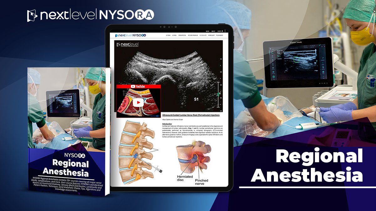 Learn about regional anesthesia procedures in a practical, condensed, easy to navigate way with NYSORA’s newest teaching materials here: bit.ly/3ap2XVJ! 

#nysora #regionalanesthesia #anesthesiology #nerveblocks