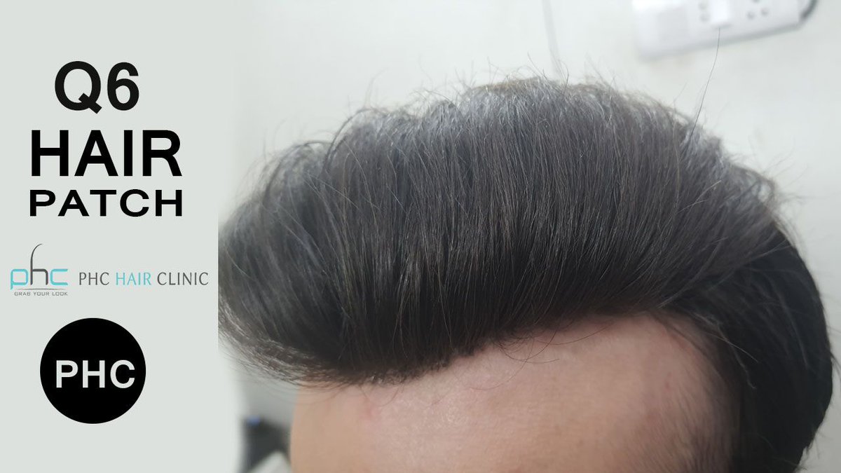Amit Chaudhary (@delhihairphc) / Twitter Amit Chaudhary (@delhihairphc) / Twitter