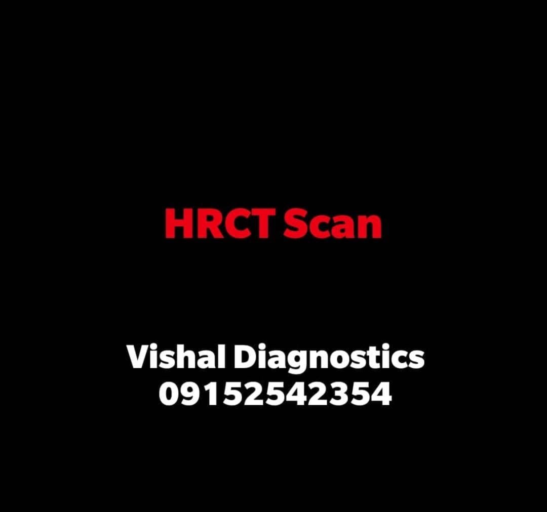 For testing and HRT SCAN in  #KANPUR