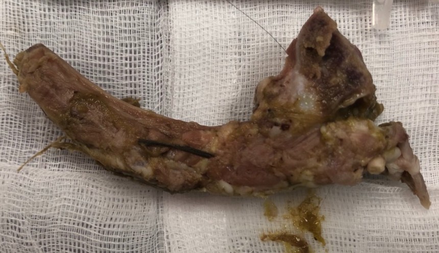 This puppy ate it's owner's roast lamb including the bone which resulted in a trip to a specialist at midnight on Easter sunday. The radiograph shows a bone lodged in the foodpipe. The bone was successfully removed using endoscopy and some forceps and the dog made a full recovery