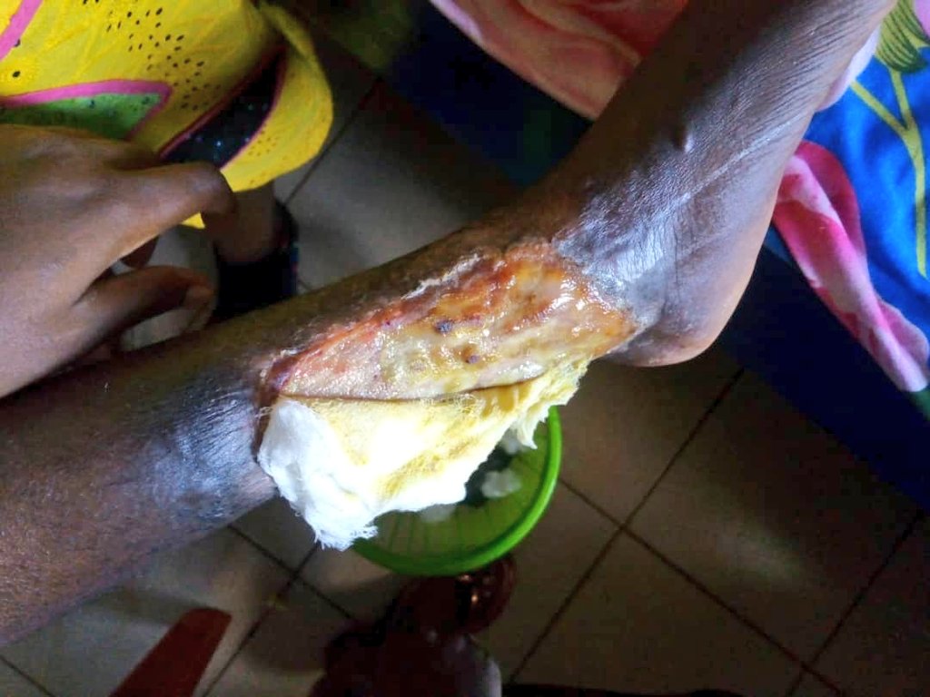 JujuofJos's tweet photo. Jos abeg help yours...
Morning guys. There comes a point in a person's life when u get so weak and tired and u need ur friends and family to help u. I am here today because my friend Talison Rhema Talison and her sister needs ur help.
3020039511 First bank Talison Lucy Iluobe https://t.co/zqhG844VKR