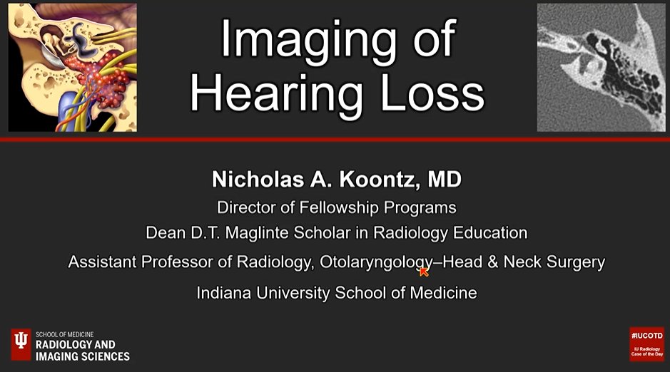 rhwiggins's tweet photo. @nkagetsu @nakoontz Don't be like #ARRS21 @nakoontz ... "Go Cubs", ... and #StopNamingStuffAfterDeadPeople , but sometimes #YouGottaDigDeep for that clinical information for #HNRad cases ... https://t.co/rsiB3STXVc