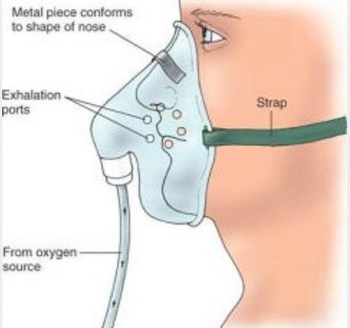  Ensure that the face mask fits snug on the face and there are no leakages around the nose and cheeks. Use proper sized mask. Press metal clip to seal the mask against the nose. Tighten straps to seal the mask against the cheeks. (This will again make your cylinder last long.)