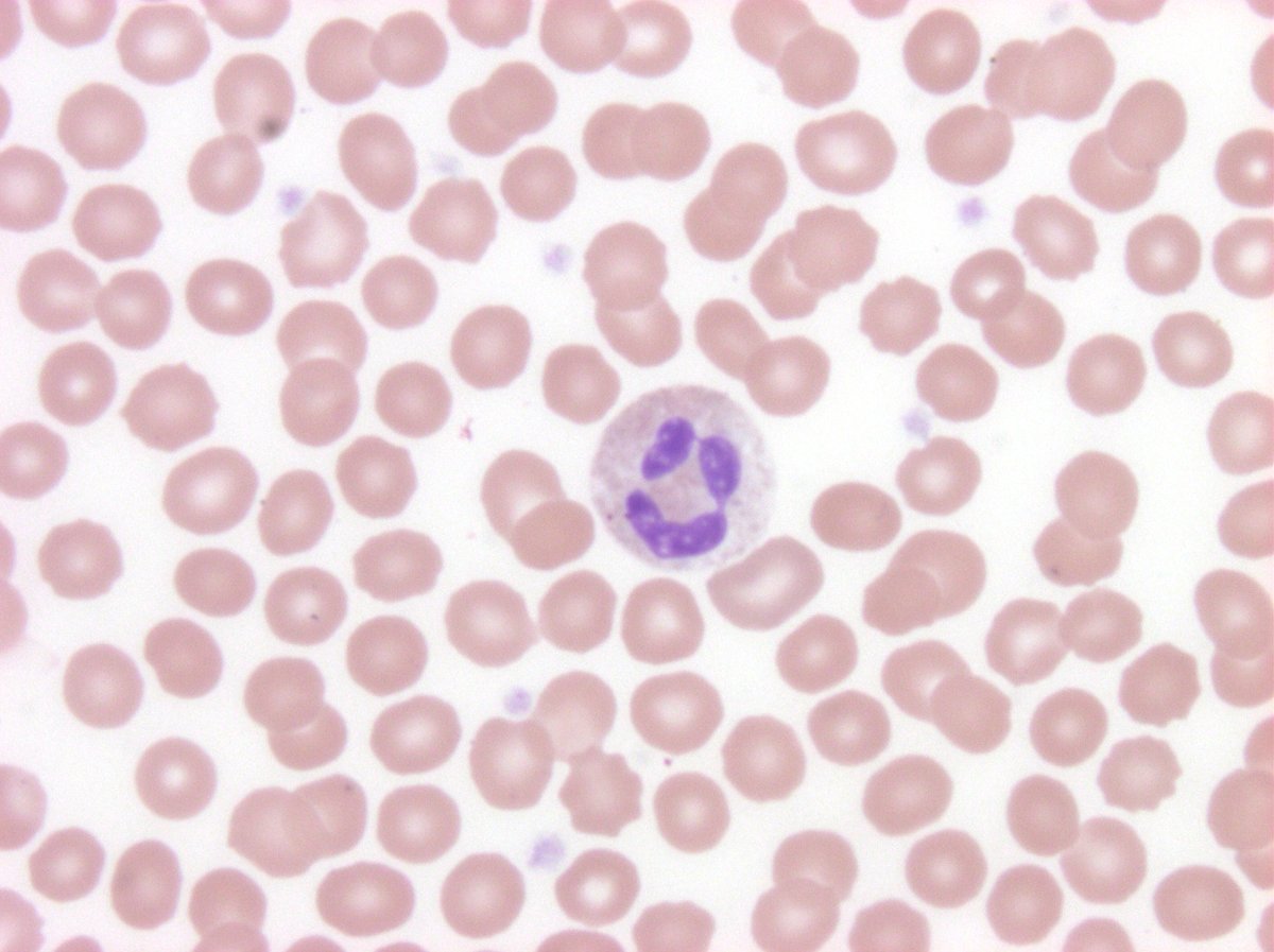 #hemepath Have a nice...whatever