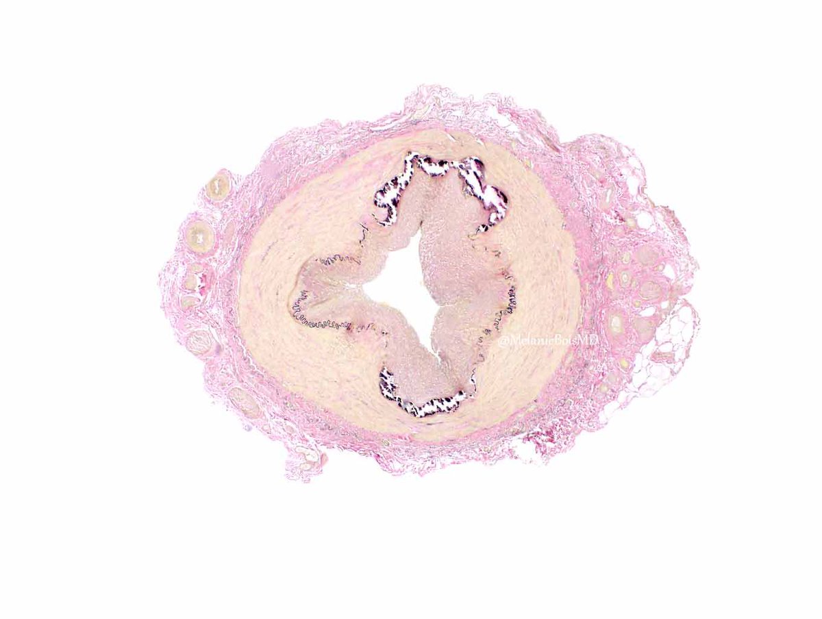 MayoClinicPath tweet picture