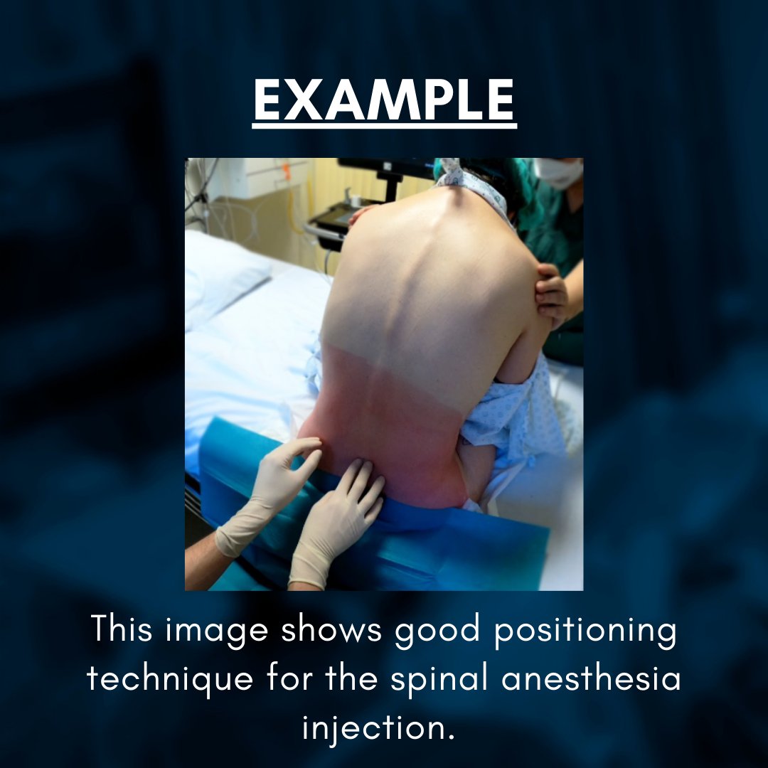 NYSORA (@nysora) on Twitter photo Calling on our community to contribute images and tips for the all new NextLevel NYSORA! <a href="/DrBluesNYC/">Prof Admir Hadzic</a> <a href="/anesthesiahq/">AnesthesiaHQ</a> Calling on our community to contribute images and tips for the all new NextLevel NYSORA! <a href="/DrBluesNYC/">Prof Admir Hadzic</a> <a href="/anesthesiahq/">AnesthesiaHQ</a>