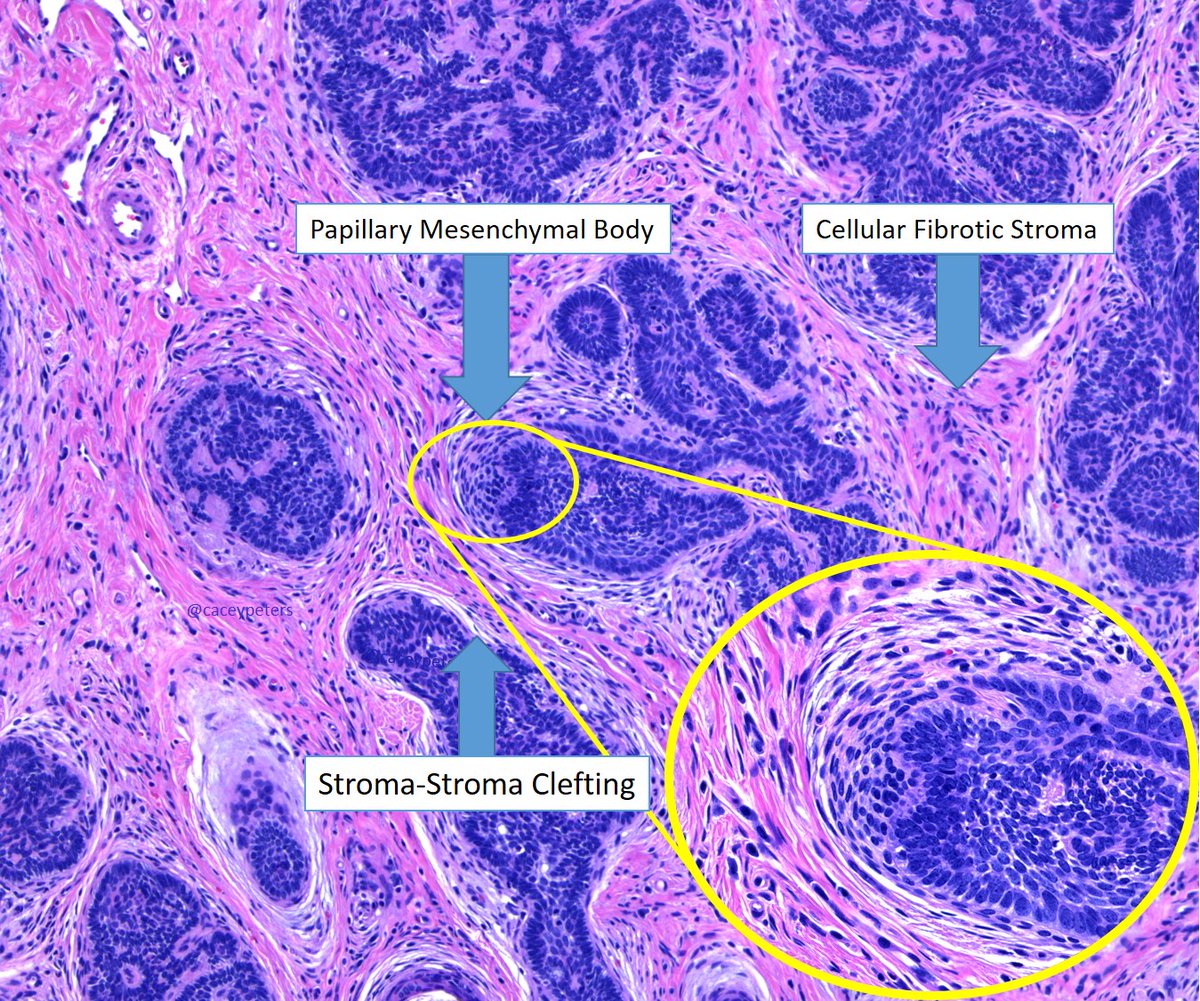 caceypeters's tweet photo. Well, hey there... what's your name?
#dermpath #dermtwitter #medtwitter #pathtwitter #dermatology #dermatologia #MedEd #histology #pathology https://t.co/hUqzBvH5xu