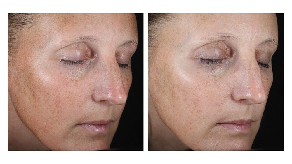 miriderma's tweet photo. I wrote a #blogpost a while ago about my love for one of @SkinBetter Science’s hero products: AlphaRet Overnight Cream.
DM or book a COMPLIMENTARY skin consultation for more information and try out this luxurious product.
#SkinTalks #retinoid #glycolic
https://t.co/AGJdJYylVy https://t.co/Chjp5xaNKf