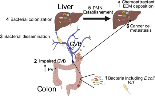 Online Now: Bacteria break barrier to promote metastasis dlvr.it/RyDkDX